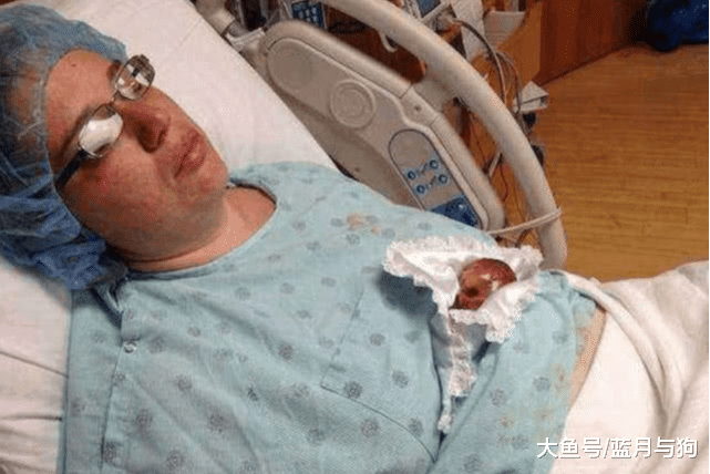 宝宝出生只有280克，世界上最小的宝宝成功存活，母亲伟大的母爱