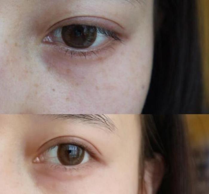 靠一瓶精华就能“打天下”？美白效果堪比换肤，李佳琦：再不用就晚了