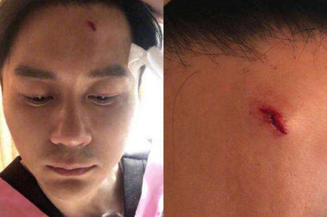 在综艺中出意外的明星，李晨头缝22针，他抢救六天还是不幸死亡！