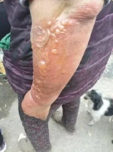 故意纵火烧死大批猫咪在中国能否定罪？