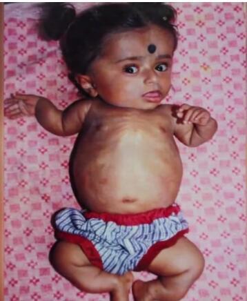 19岁少女一幅画可卖一万元，却只能每天躺在婴儿车里