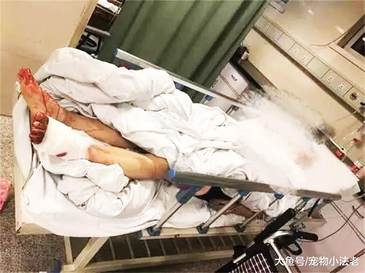 2女遭4只疯狗撕咬，狗主袖手旁观，只说了1句：我力气小拉不住