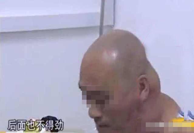 男子酷愛喝酒，一年后脖子變成河馬脖，醫生檢查后大罵活該