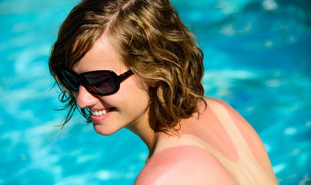 炎炎夏日，晒脱皮了怎么办 试试这晒脱皮了怎么处理恢复快