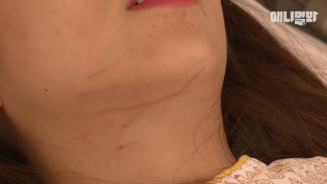 睡着了就会变成恶魔, 萌猫每晚抓伤主人, 只因它会做噩梦并且梦游