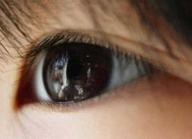 心理学：第一眼你最喜欢哪只眼睛？秒测异性最喜欢你哪一点