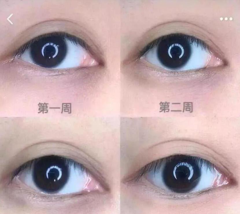 药店最火的“变态”发明，3次眼袋细纹全没了，半个娱乐圈人手一支