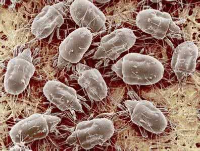 九月不晒被，亿万螨虫陪你睡！老奶奶教你一个除螨绝招，螨虫全部死翘翘