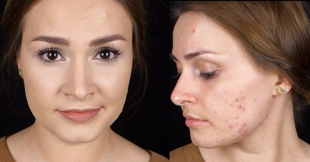 这些毁肤手法碰不得，现在补救还来得及