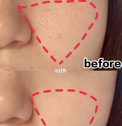 有一种白色的慕斯膏，美白嫩肤都不在话下，可惜没几个人知道