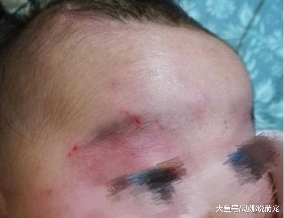 未满月的儿子被4岁女童痛打，妈妈只能忍：她“后台”太硬了！