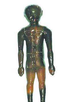 古墓出土920枚楚竹简, 让失传千年“九阴真经”横空出世动摇医界