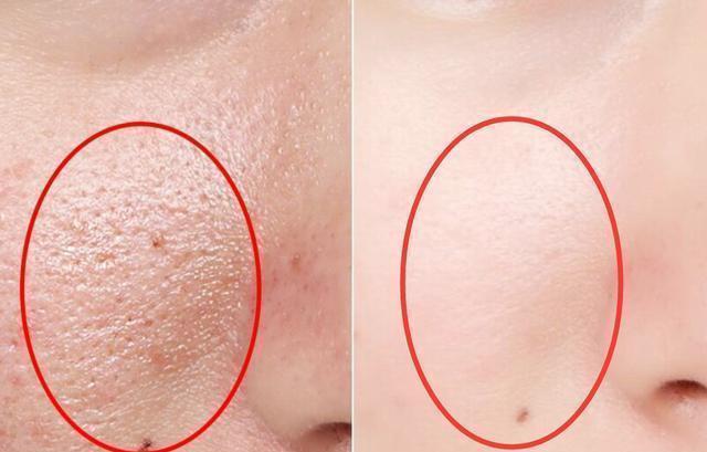 医学院“骨灰级”博士曝光：药店一“阴性药膏”，抹一抹，色斑迅速退场