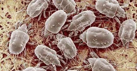 立秋后，家中螨虫繁殖增长，专家说道：卧室放一晚，螨虫连根拔除