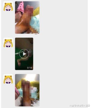 母女被四条狗围着咬，狗主人却在旁边看着女孩的妈妈被咬到休克！