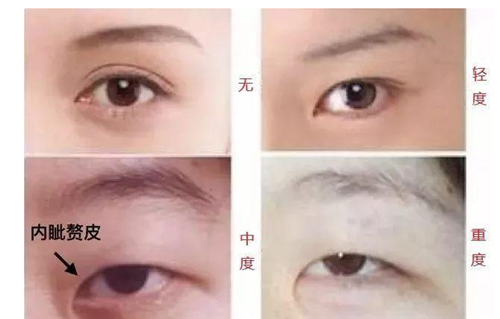炎黄子孙有3大特殊“印记”,永远无法抹掉,若你有,那就没错了