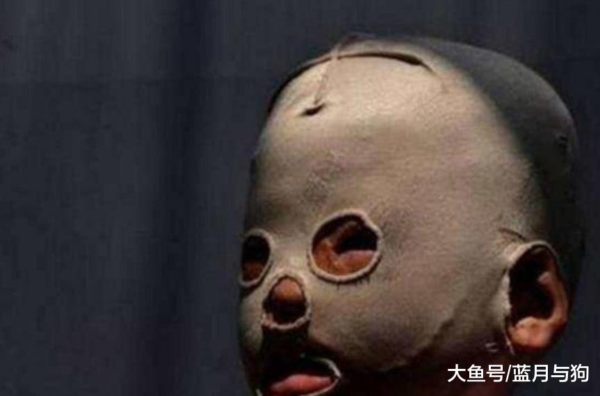 为了不被其他同学嘲笑，带上了面罩，当他摘下面具后众人心疼