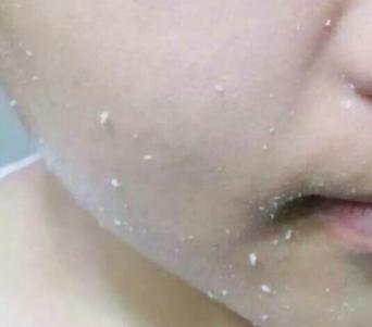 面膜 女人常见的护肤误区：水乳一年不换，频繁贴面膜，你中几个？