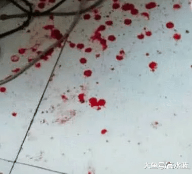 猫咪外表温顺老实，实则是折磨人的小魔女，主人被害直接进了医院