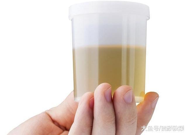 男人若“肾气不足”，晨起可能3处发臭，2处发黄，尽量别忽视