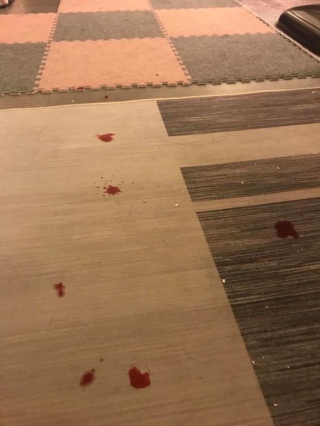 主人熟睡时被狗狗啃咬，但没有责怪狗狗，它已经老了它也不想的