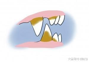 辟谣：猫咪吃干粮就不用刷牙？麻烦你撬开喵星人的嘴巴看看