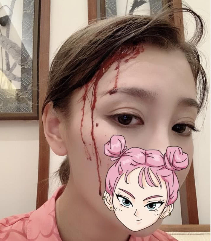 继唐菀离婚后首复出，竟晒“流血”收工照，“受伤”造型吓哭孩子