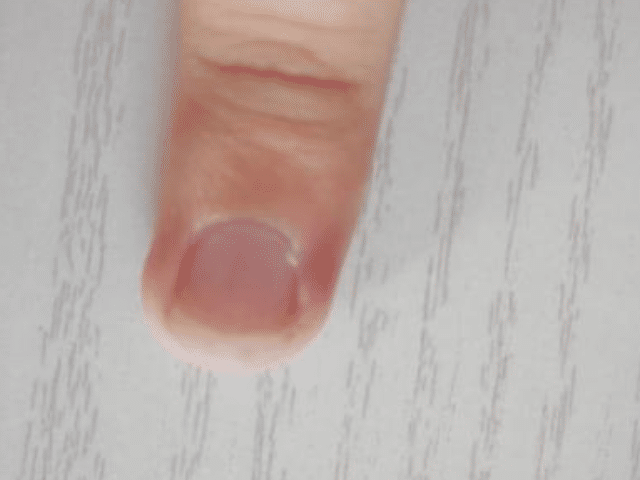 肾脏功能“稀烂”的男人，手上“3特征”贼明显，快自检