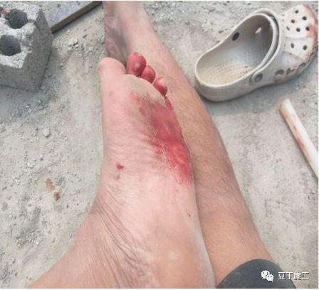 木工安全培训教育资料总结, 可以直接拿去用(含今年事故案例)