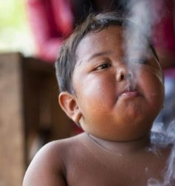 2岁男童因一天抽40根烟名闻世界，强制戒烟3年后，变成这样