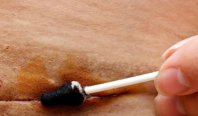 剖腹产时,伤口缝线处理是用美容线好还是拆线的好?