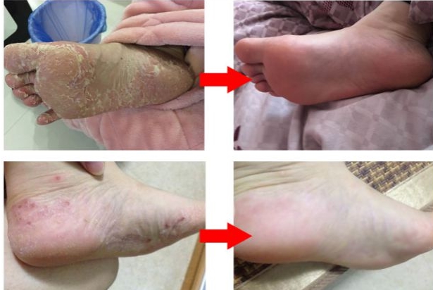 乡下田野边常见的一野草，却是脚气“大天敌”一用一个准，有脚气的快存