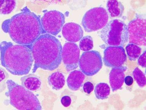 可能造成血癌的不光是甲醛，还有这几种食物，白血病的最爱啊！