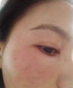 别傻了，你根本不会敷面膜！不想烂脸的，赶紧学学