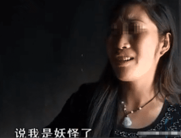 新婚初夜丈夫一走了之, 妻子上门质问被拒, 丈夫: 这腿太吓人了