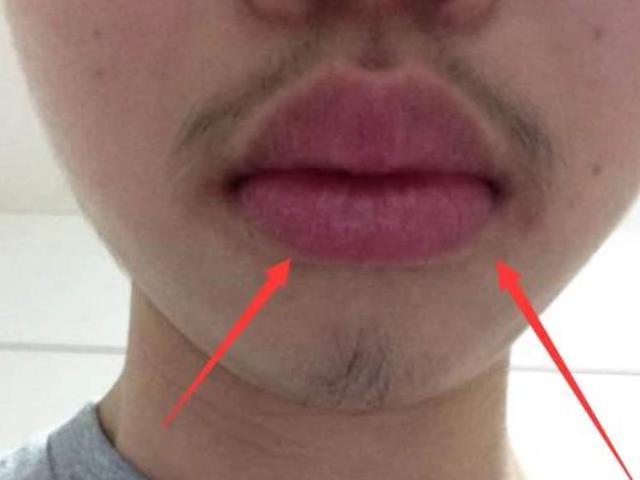 肾功能“稀烂”的男生，身体会亮起3盏“红灯”，别硬撑到尿毒症