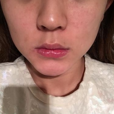 求求你住手！这样混用护肤品不烂脸才怪！