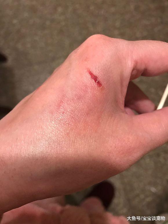 600买下只成年泰迪，喂养不到两月连咬我三次：这狗还能养吗？