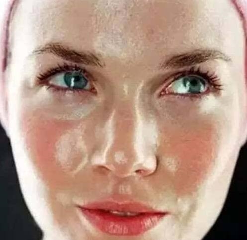 脸上螨虫超级多？教你一个土办法，不到一毛钱，螨虫全部死光光，全军覆灭