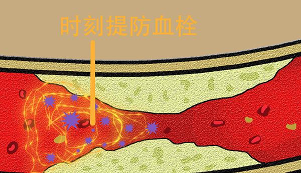 血管慢慢堵了？患上血栓前，身体会亮起四处红灯，别大意