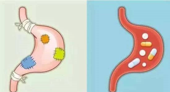 幽门螺旋杆菌感染阳性，做到这两点，清除不难，远离胃病！