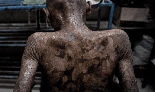 世界上“第一个艾滋病”到底如何产生的？网友：看完真的很心痛