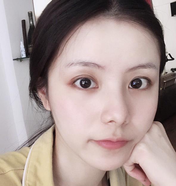 娱乐圈爆火的“变态精华液”，大黄脸10天就没了，一线女星：人手一盒