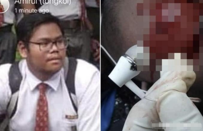 国外一男孩睡觉时戴耳机听歌, 第二天家人竟含泪为他盖上白布!
