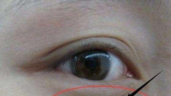 药店有个“神奇小怪兽”, 只需120秒眼袋全消失, 效果不输激光