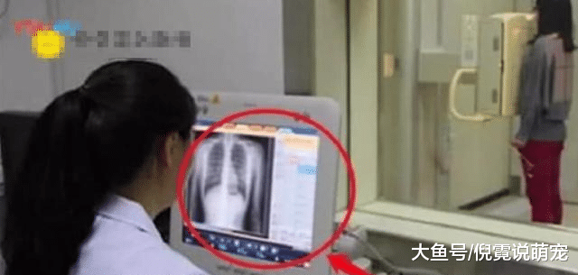 女人为何不愿做“胸透”？医生都能看见什么？