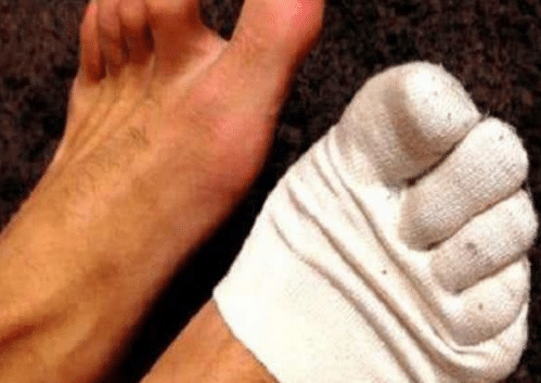 肾“不好”的人，脚上会先发出“3种预警”，早就医别拖至尿毒症