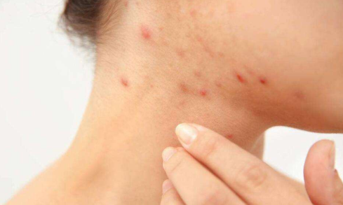 肝癌，对于这三种人要注意，身上这两处痒要小心