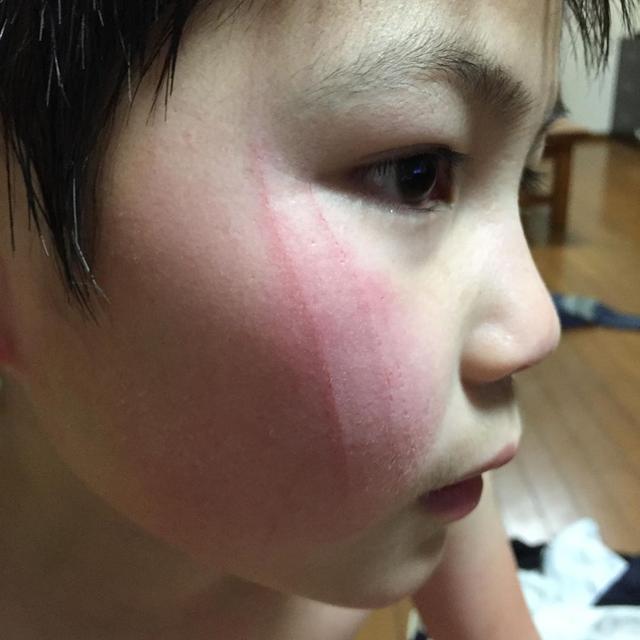 小主人想撸猫，结果脸上被抓出3到伤痕，他不放弃拿出秘密武器