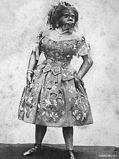 她被称为“世界上最丑的女人”死后尸体被拉到全世界展览。